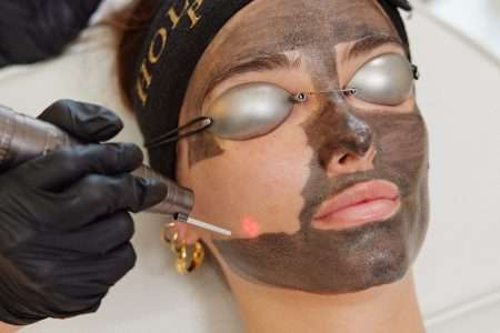 hollywood peel